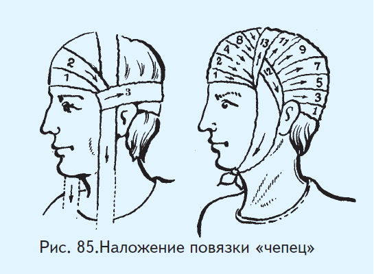 Перебинтовать голову схема